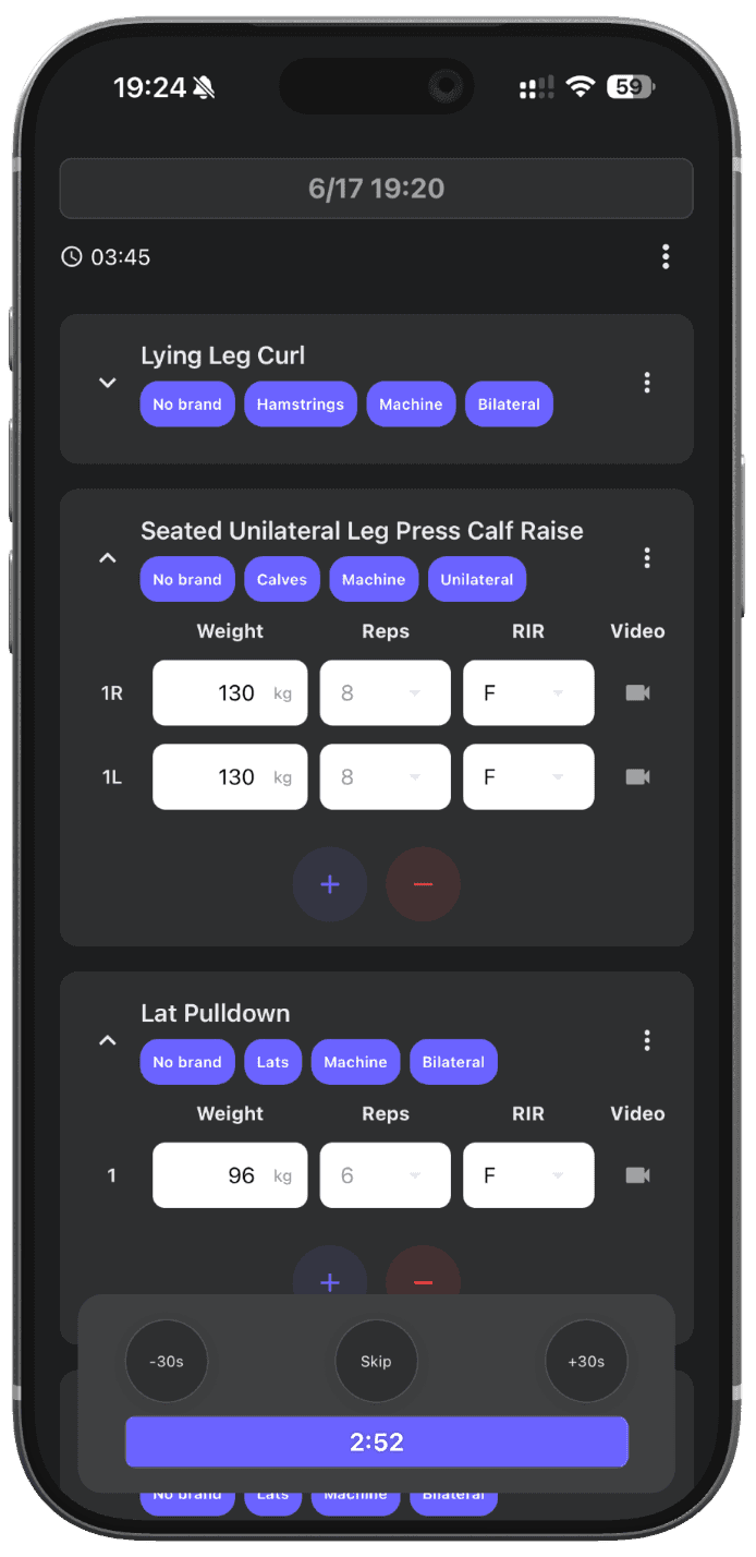 Auto-start rest timer